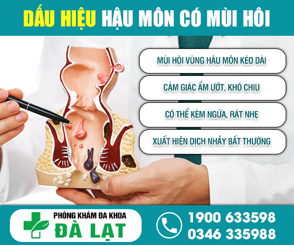 Hình ảnh minh họa